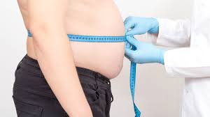 obesidad